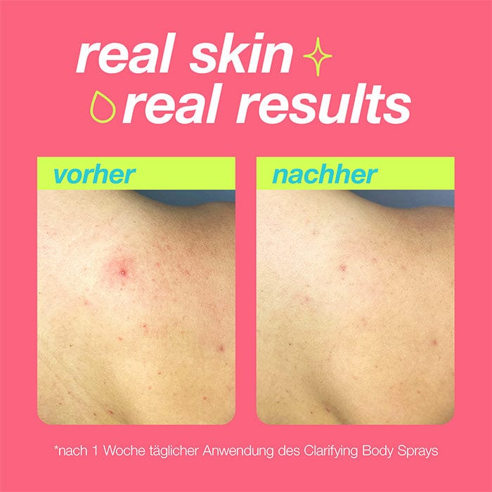 Clarifying Body Spray - Image 5