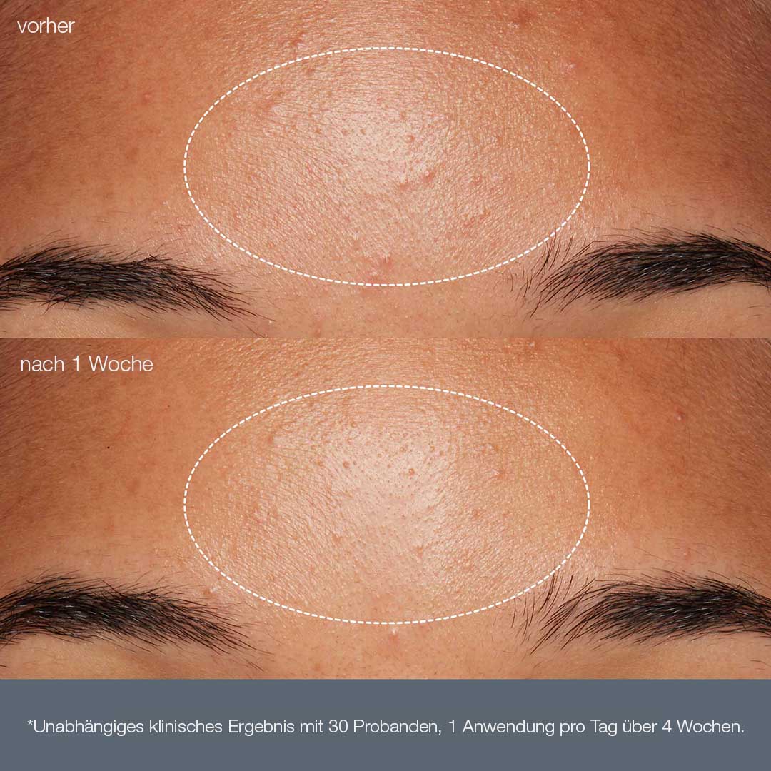 Daily Microfoliant + Special Cleansing Gel - Image 3