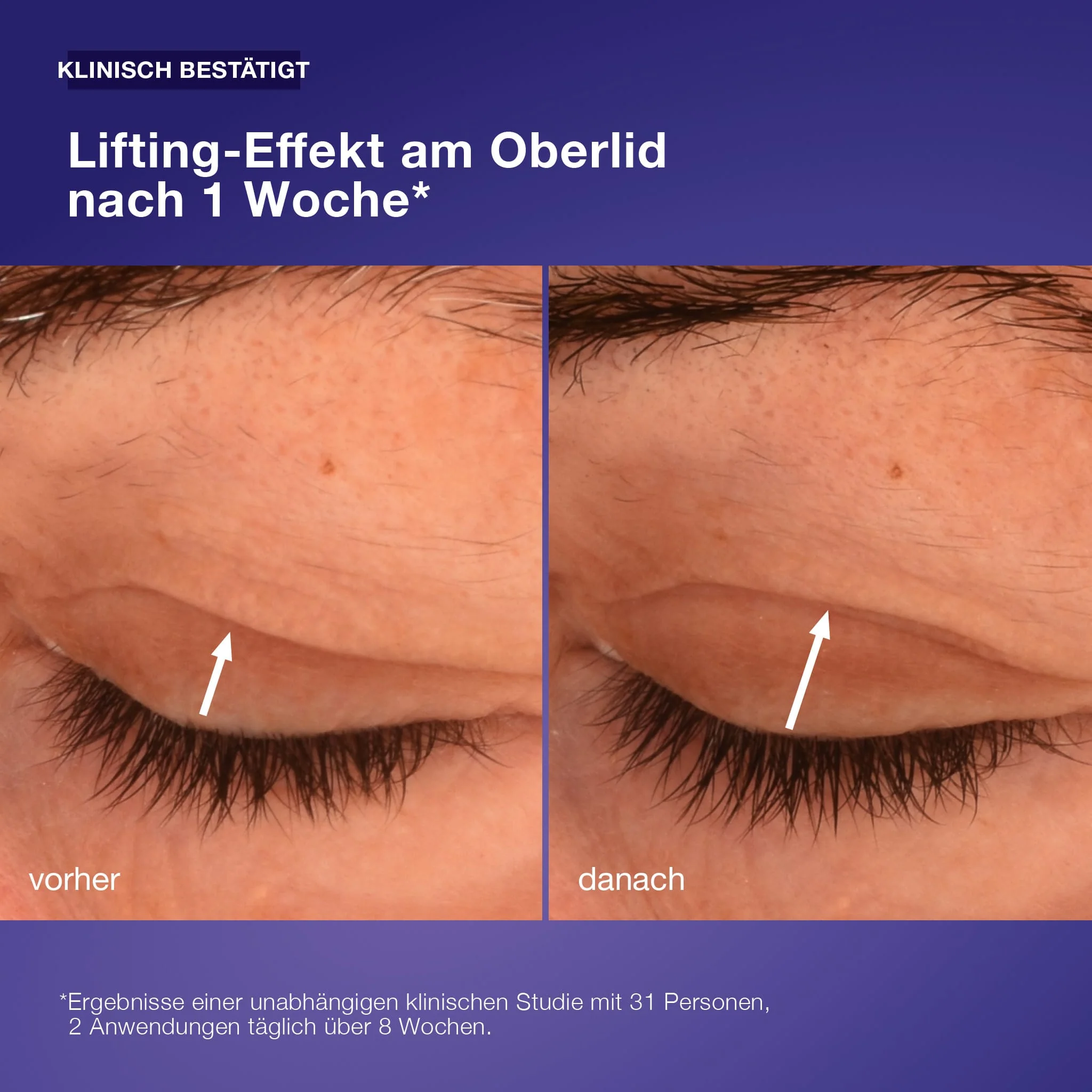 Phyto Nature Lifting Eye Cream - Image 3
