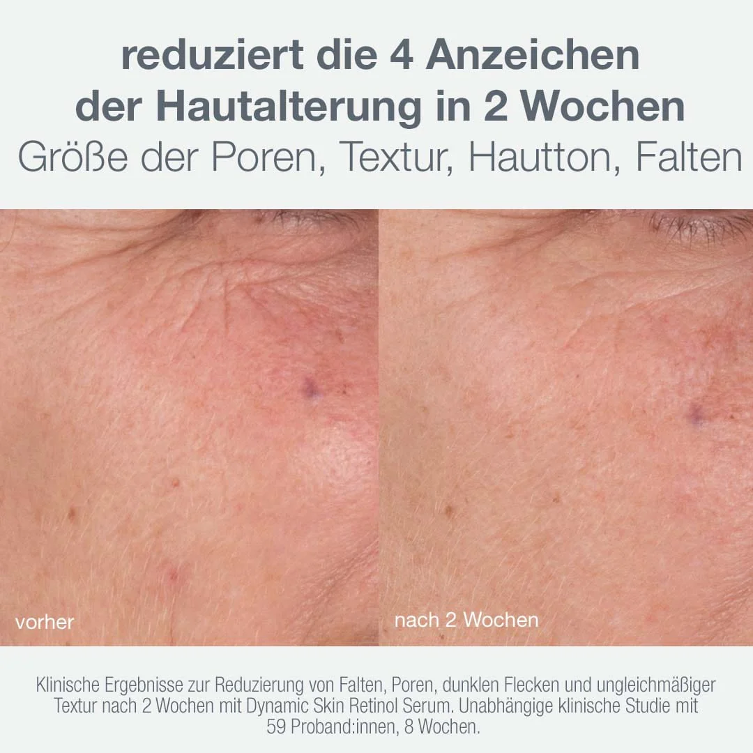 Skin Aging Solutions Set - Image 5